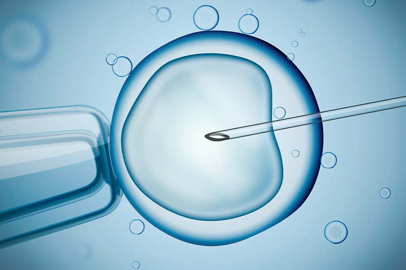 Fertility Treatment